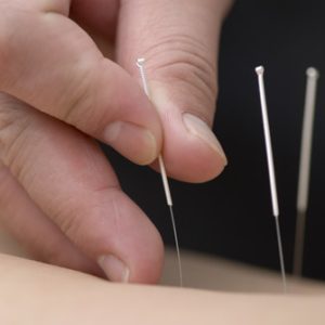 safety_in_acupuncture_2_1y