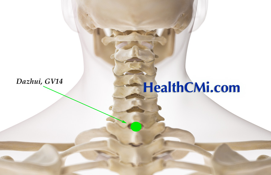 acupuncture ceugv14asthma