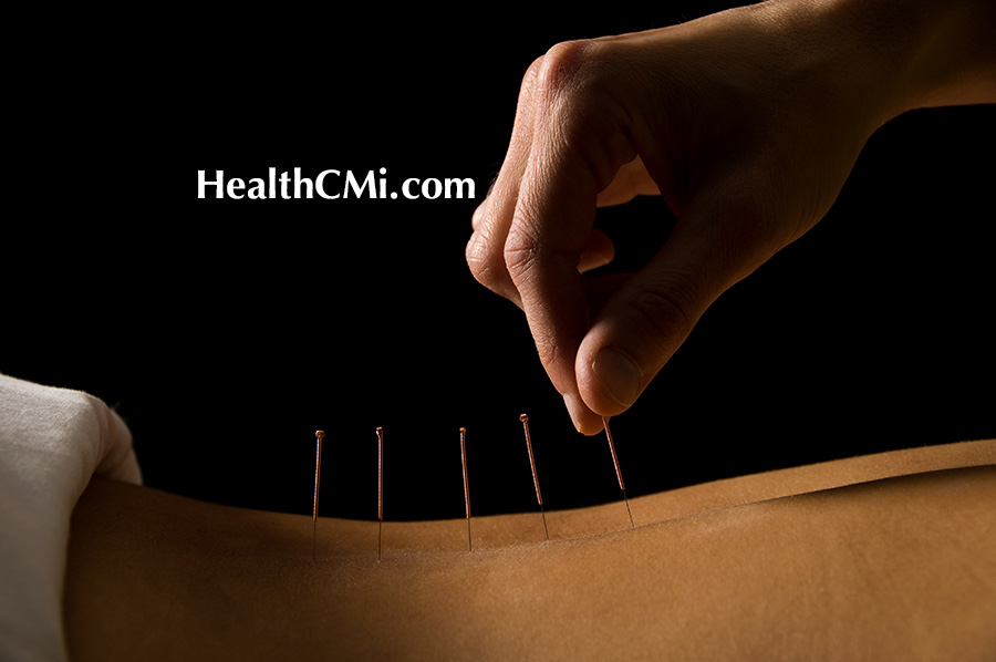 parkinsons disease acupuncture