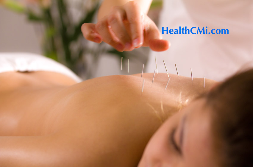 acupuncture ceu bl11 RA