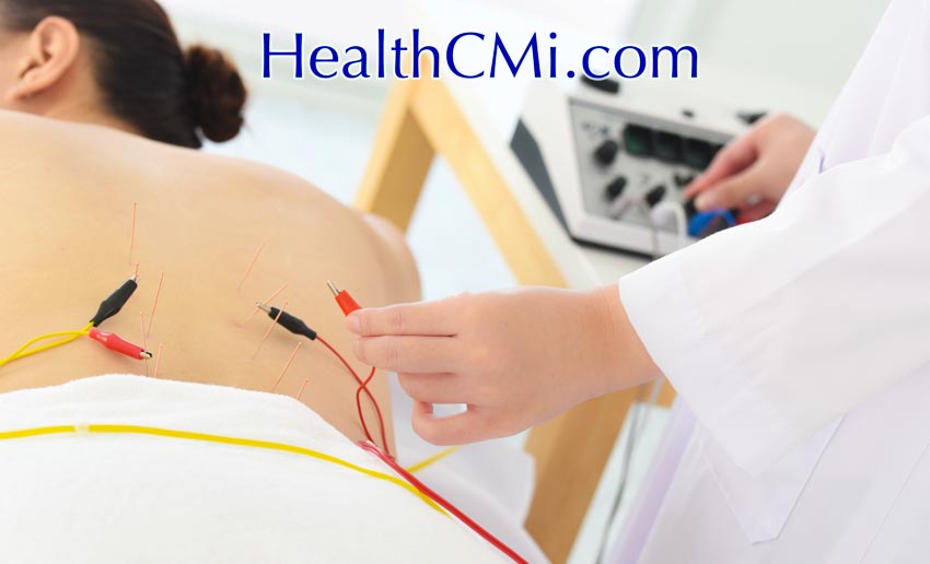 acupuncture ceus online