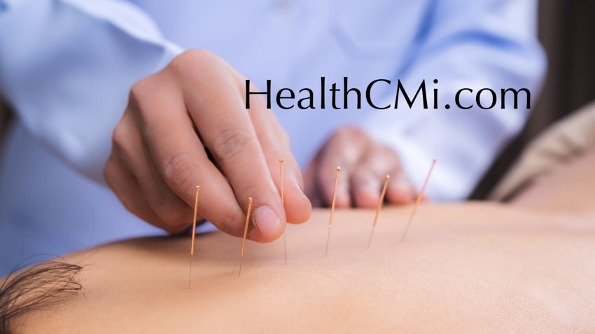 acupuncture education online