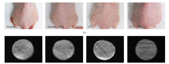 Images of UVB damage and protection from the study. 