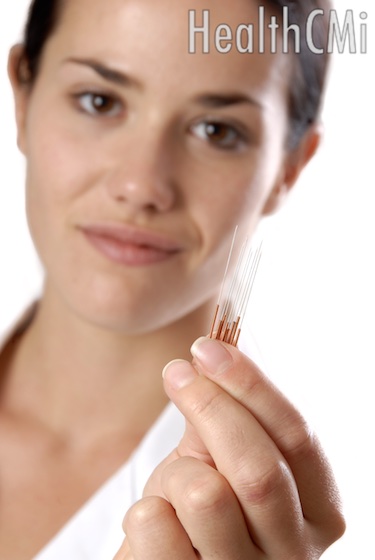 Acupuncture needles with copper handles