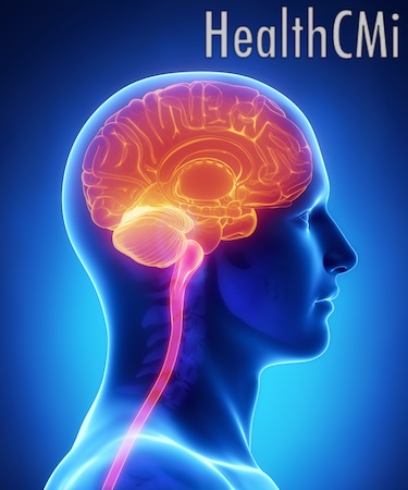 Photoacoustic imaging of the brain on needling KD1. 