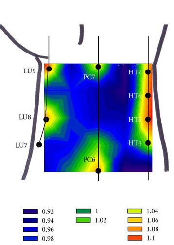 Wrist needle points with high oxygen levels. 