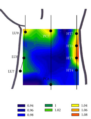 Another wrist needle area with high oxygen levels. 