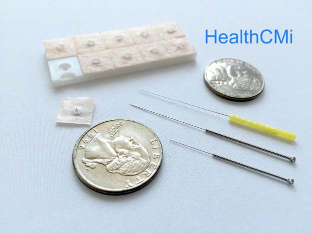 Japanese and Chinese needles plus auricular needles