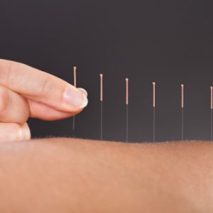 safety_in_acupuncture_3_1y