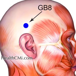 Acupuncture For Headaches & Depression 10-07-25