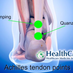 Acupuncture For Achilles Tendinopathy
