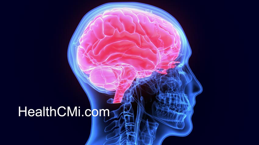 HealthCMi stroke study