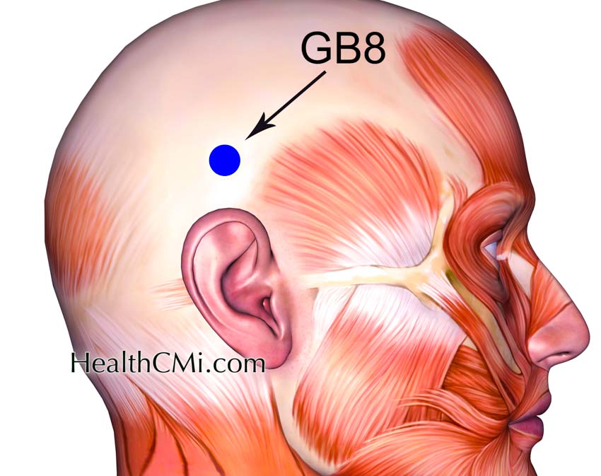 acupuncture GB8 shaigu