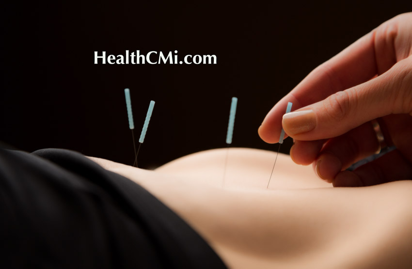 acupuncture ceu adenomyosis1