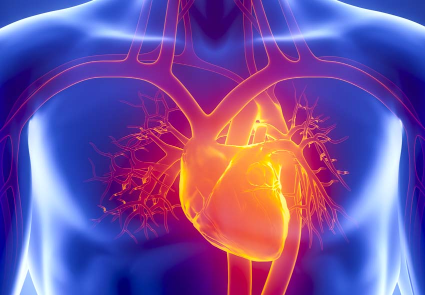 arrhythmias