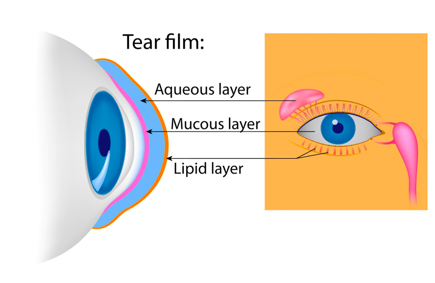 dryeyesyndrome