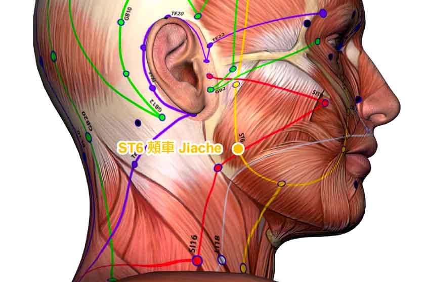 st6 jiaache acupoint