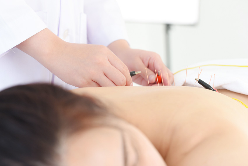 Benefits of Acupuncture