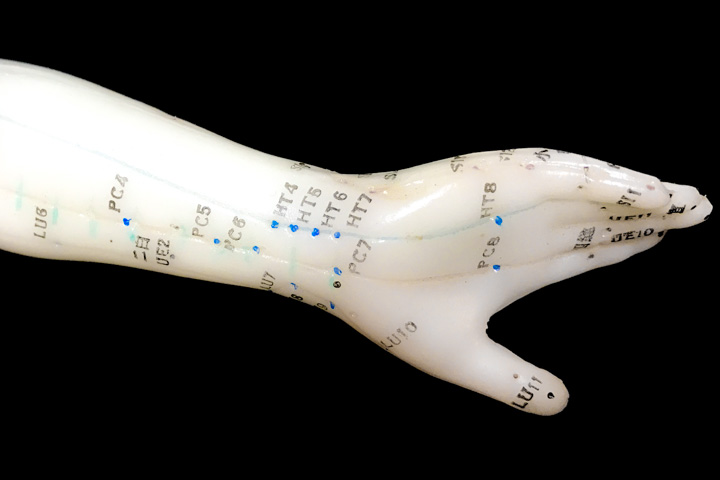 HT7 (Shenmen), PC6 (Neiguan)