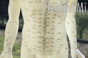 Acupoints CV9, ST25, CV6, and CV12 on an acupuncture model. 