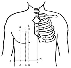 A novel approach to pont selection is depicted. 